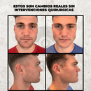 Ejercitador de mandíbula: define tu rostro y resalta tu mejor versión. 💪🔥