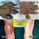 🦴 Beevana™  - Crema para el dolor de articulaciones 🦴